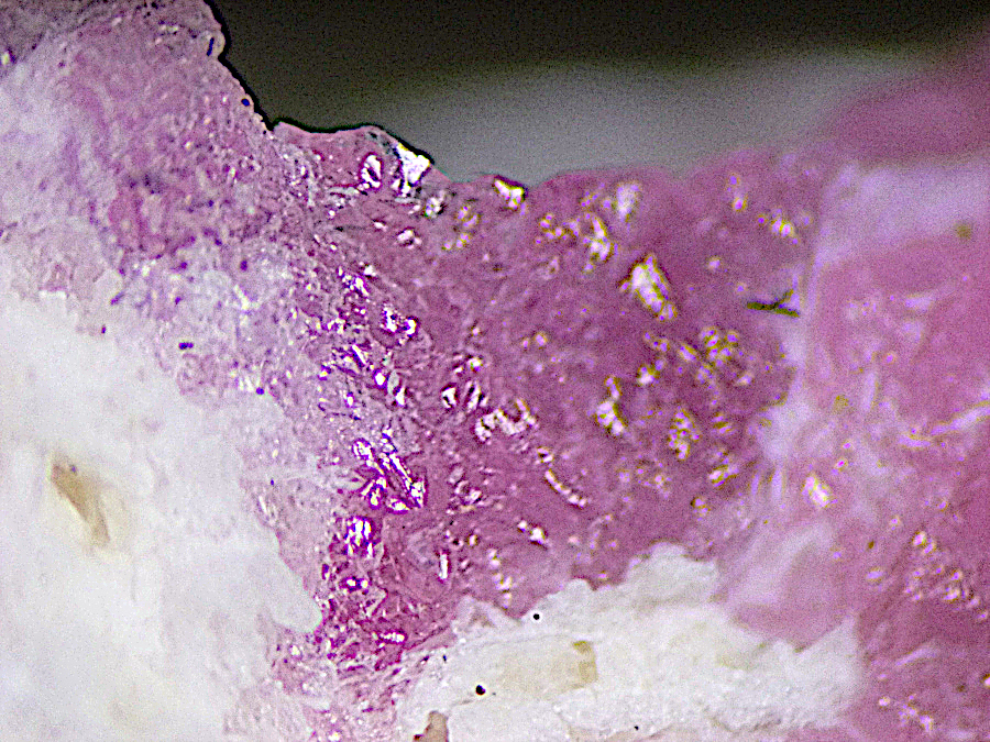 Tugtupite